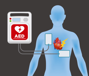 Defibrillator einsetzen - So einfach ist der Umgang mit einem AED Gerät